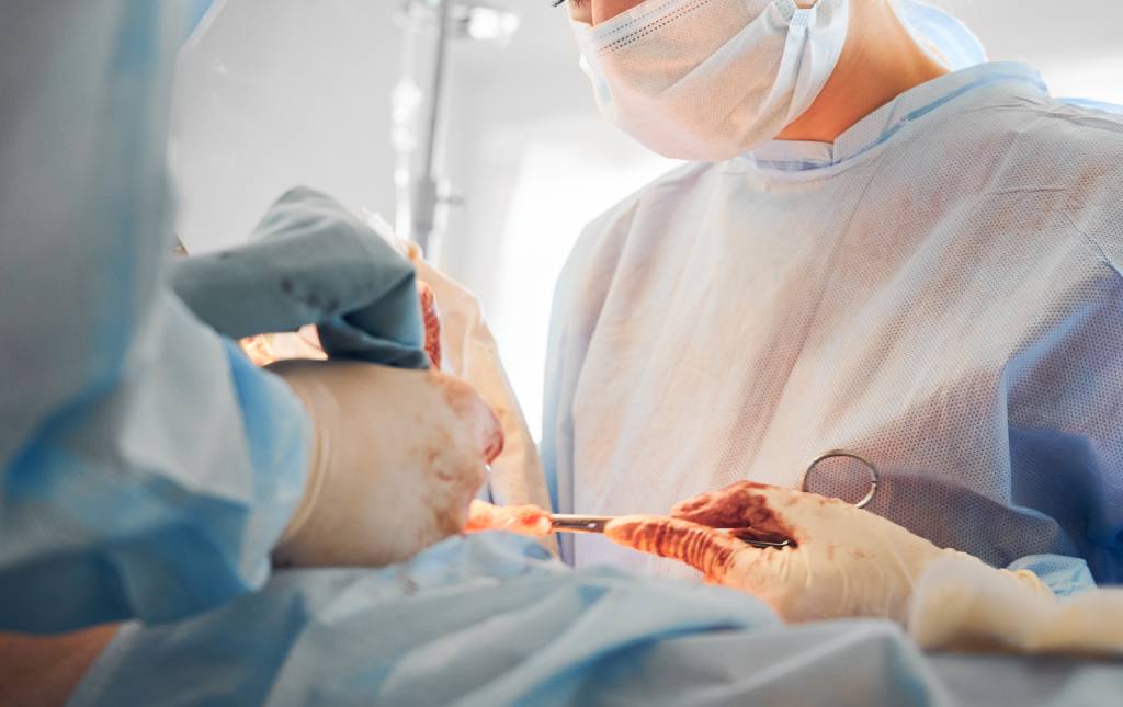 Cesáreas Ginecología en Mérida