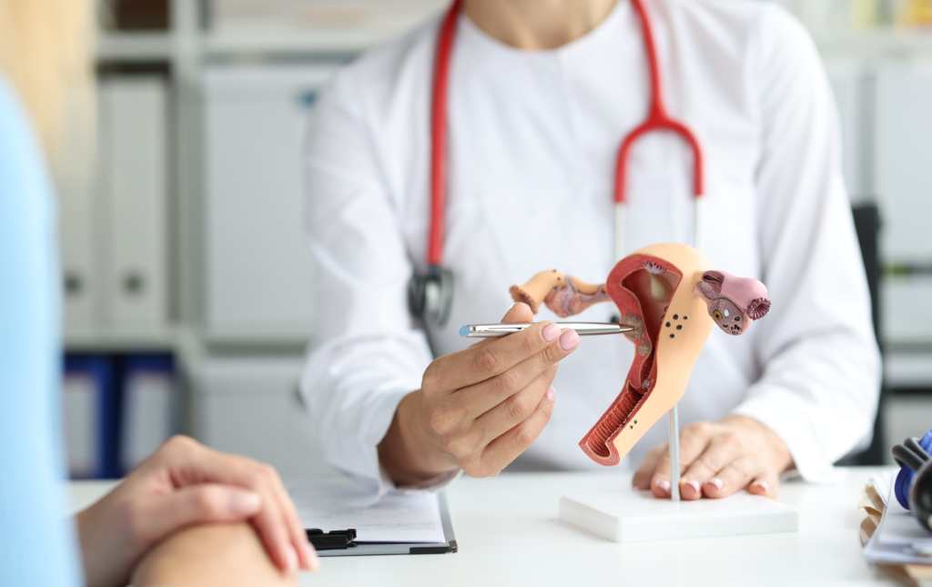 Histeroscopia Ginecología en Mérida